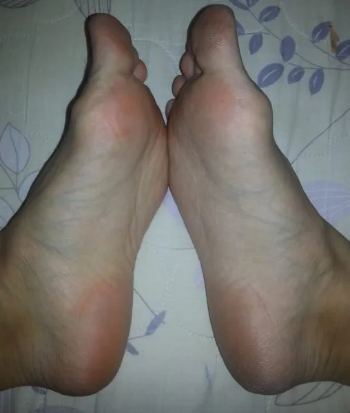 Ноги после 1 применения DOMIX GREEN PROFESSIONAL «Жидкое лезвие»