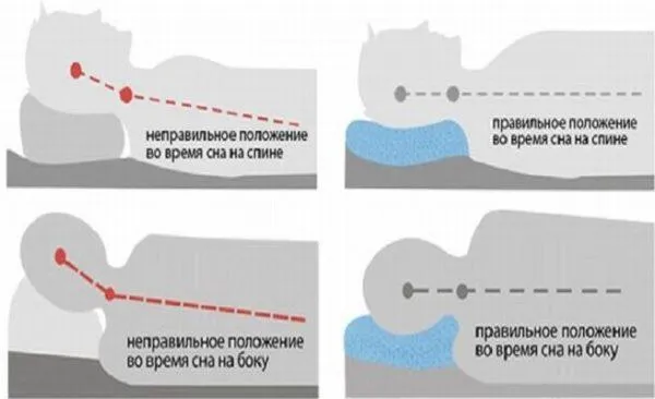 Правильное положение для сна на спине и боку